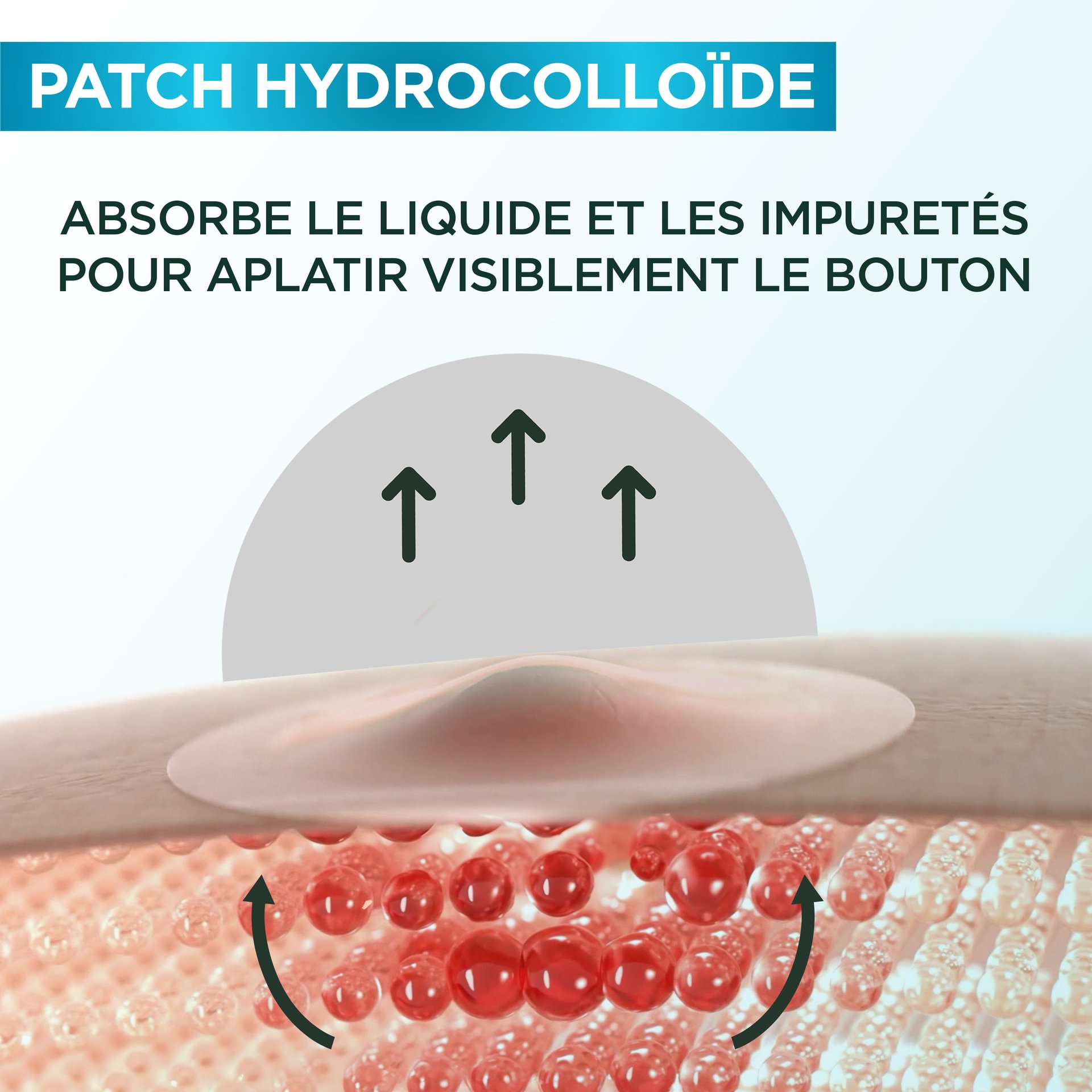 Pimple Patch Benefits